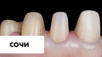 Трансформация клинического приема с учётом концепции FDO (М. Кувата) Трансформация клинического приема с учётом концепции FDO (М. Кувата)